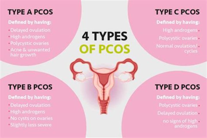 Is there different severities of pcos?